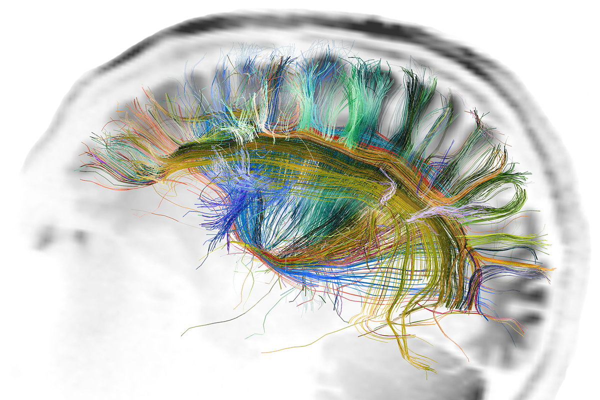 Human Connectome Project Image